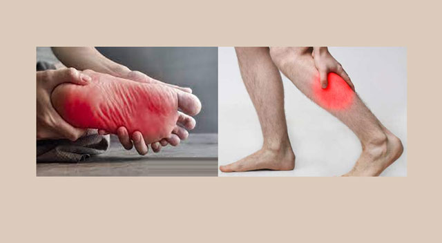 پیروں کے تلوے کا جلنا اور ٹانگوں کا درد کا علاج